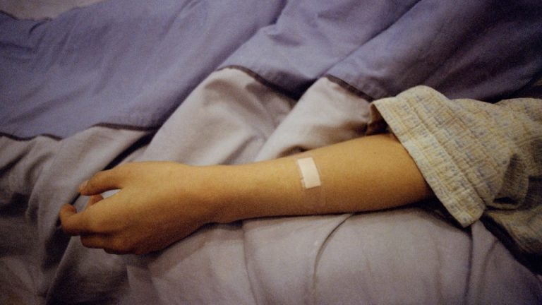 A patient's arm lies flopped on a bed, with a bandage on the forearm